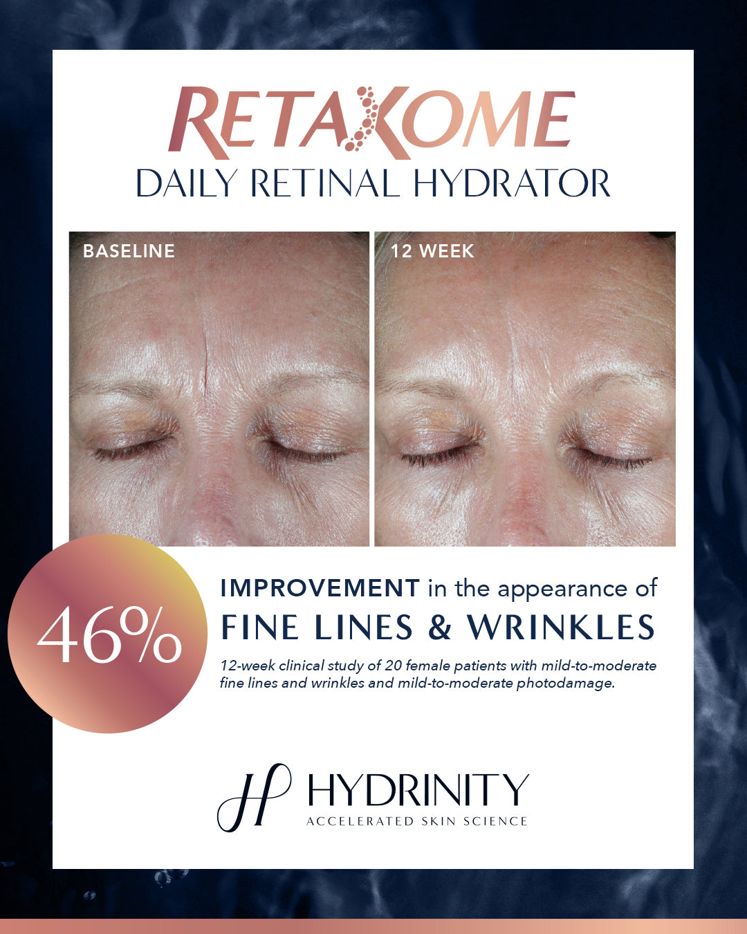 HYDRINITY RETAXOME DAILY RETINAL HYDRATOR